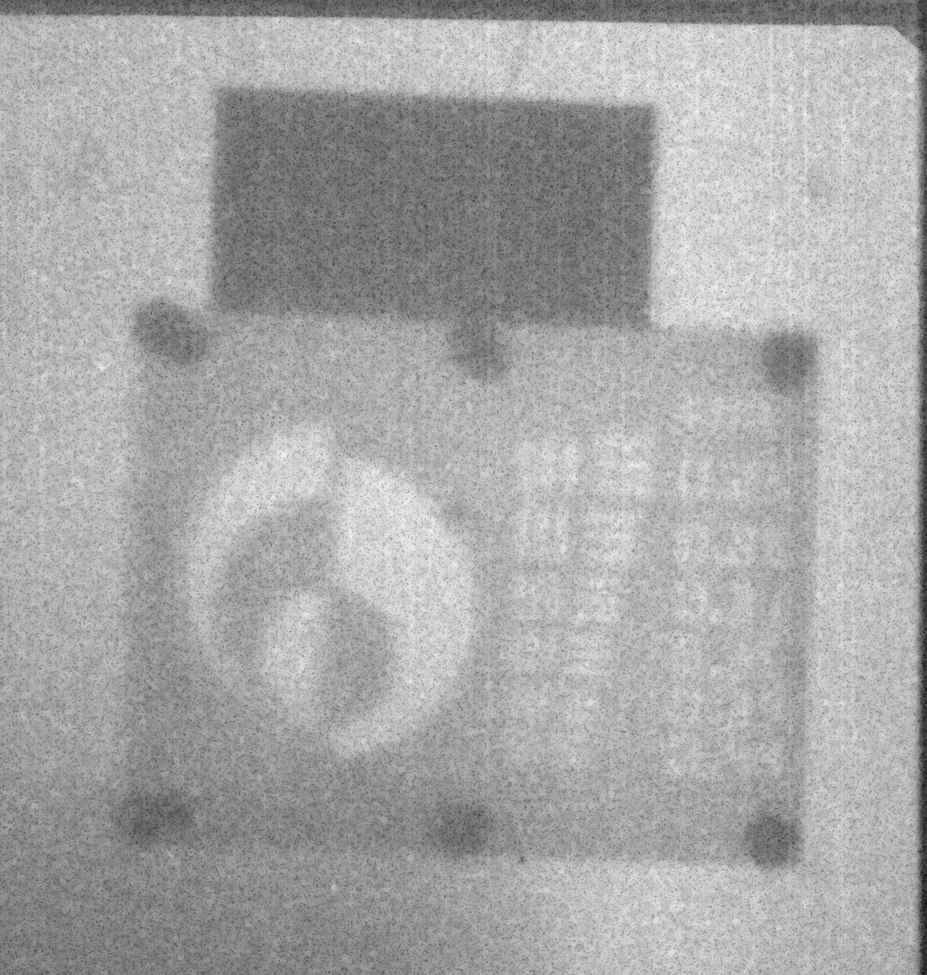Adelphi Technology Neutron Radiograph Image